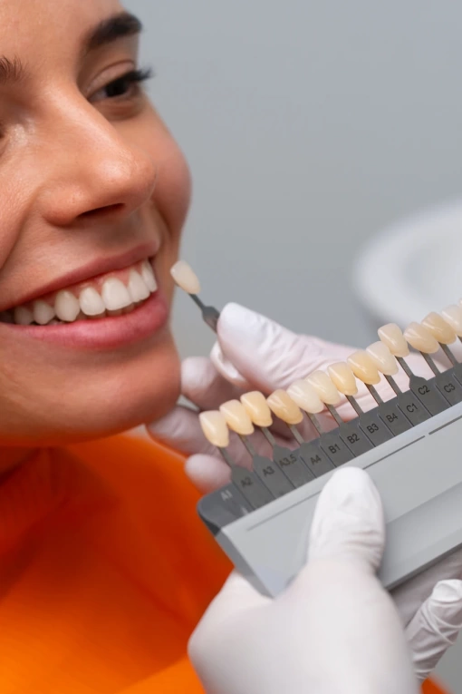 Facetas em resina composta